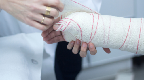 Doctor wrapping up wrist after hand fracture treatment.