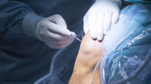 How Value-Based Care Is Transforming Orthopedic Outcomes at OrthoCarolina