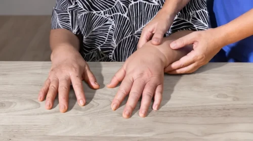 Orthopedic doctor assessing a patients swollen hand
