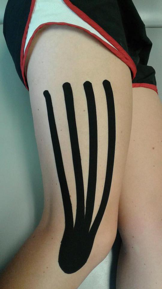 Kinesiology Tape – Tips for Maximum Benefits