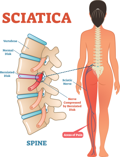 standing sciatic nerve stretches